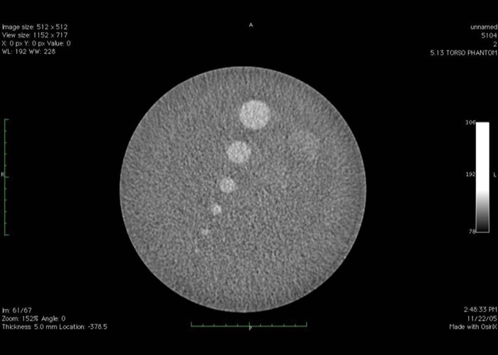 Phantom đánh giá hiệu năng máy CT AAPM