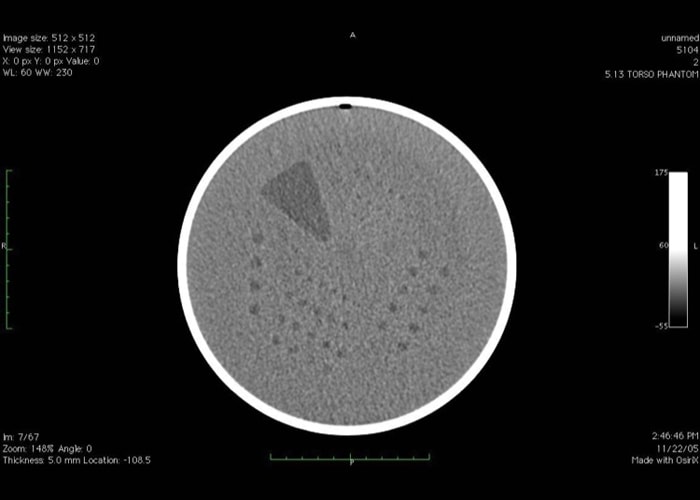 Phantom đánh giá hiệu năng máy CT AAPM