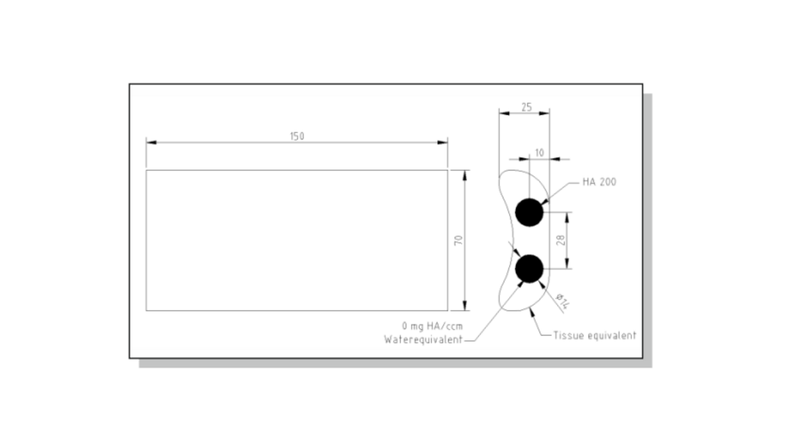 Phantom xương cẳng tay (BMF)