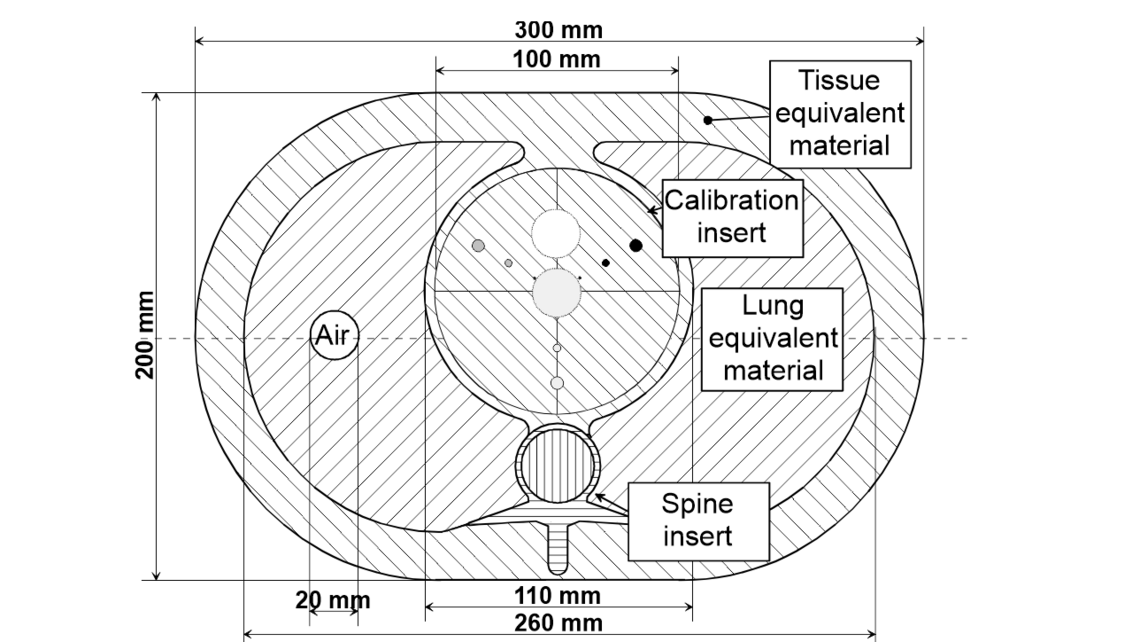 Phantom đánh giá điểm vôi hóa