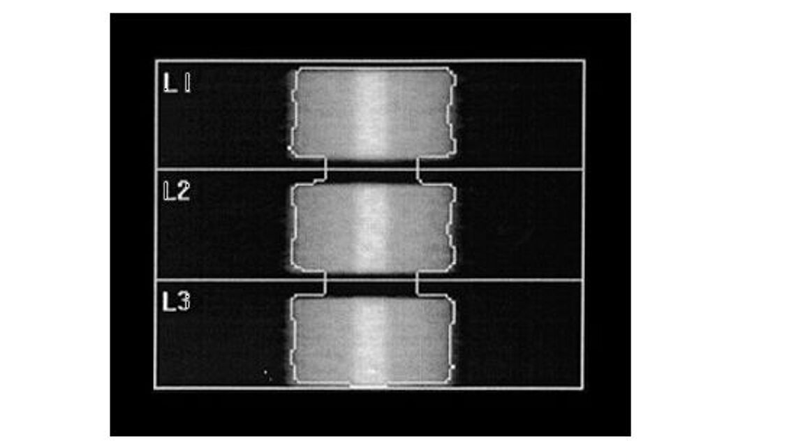 Phantom kiểm tra chất lượng xương cột sống DXA, 3HA Phantom kiểm tra chất lượng xương cột sống DXA, 3HA