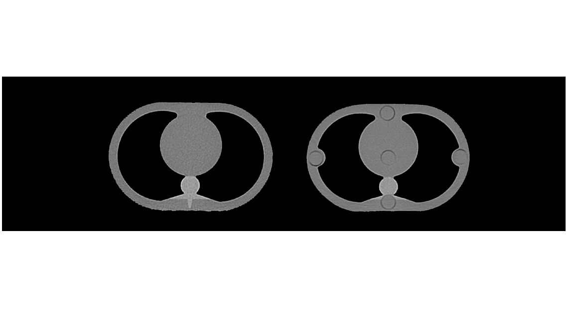 Phantom mô phỏng lồng ngực và bụng trẻ em