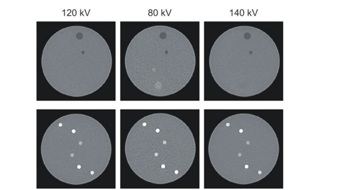 Phantom CT năng lượng kép Phantom CT năng lượng kép