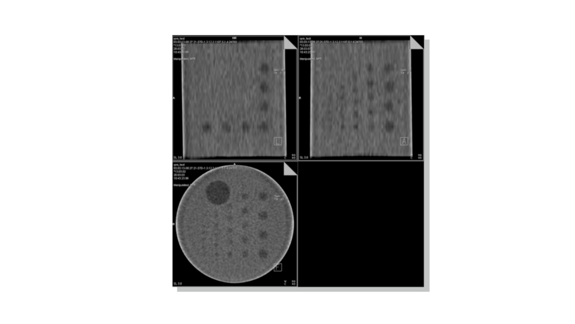 Phantom độ tương phản thấp 3D, 2D Phantom độ tương phản thấp 3D, 2D